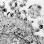 virus-htlv-1-causa-sindrome-inflamatoria-em-assintomaticos,-aponta-estudo