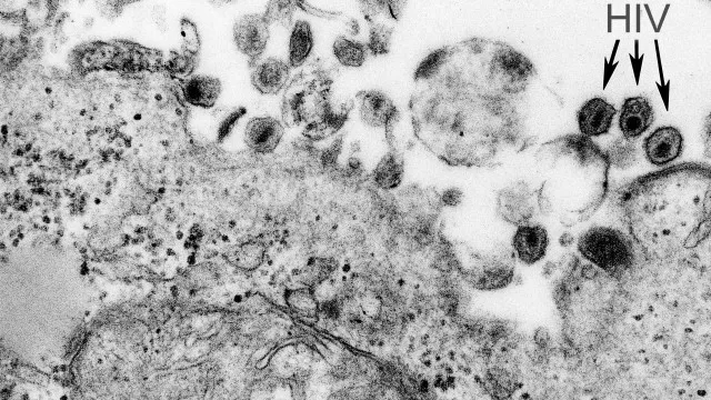 virus-htlv-1-causa-sindrome-inflamatoria-em-assintomaticos,-aponta-estudo