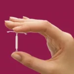 planos-de-saude-passam-a-cobrir-diu-hormonal-contra-endometriose