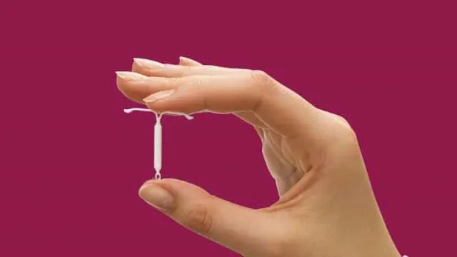 planos-de-saude-passam-a-cobrir-diu-hormonal-contra-endometriose