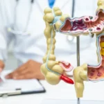 em-13-anos,-doenca-inflamatoria-intestinal-cresce-5-vezes-no-brasil
